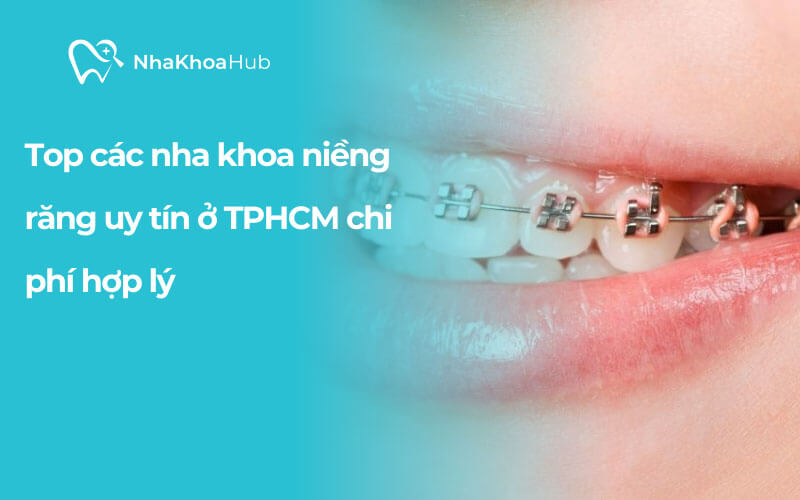 Muốn tìm địa chỉ chỉnh nha uy tín ở TPHCM giữa hàng ngàn phòng khám không dễ dàng