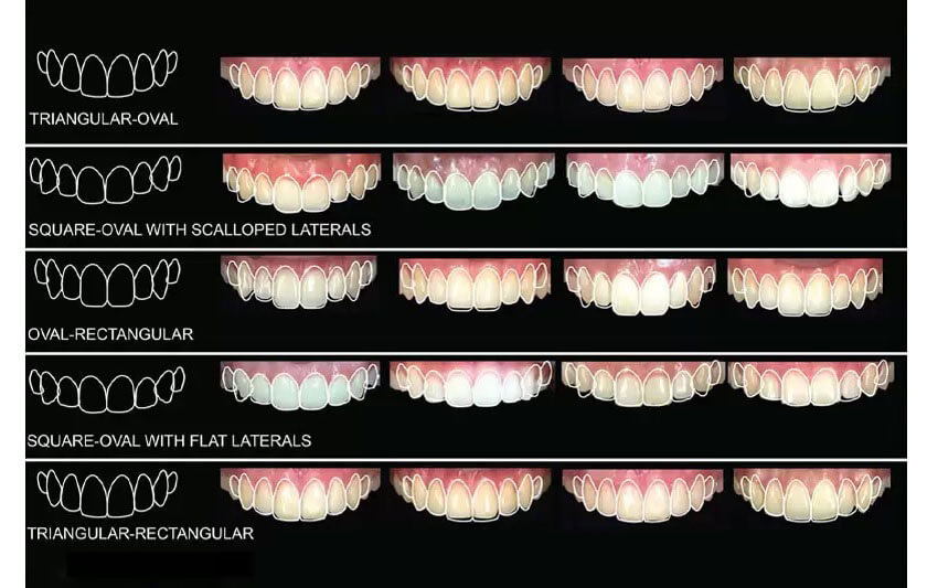 Tướng răng có thể đoán được vận mệnh của chủ nhân