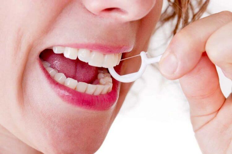 Chỉ nha khoa loại bỏ thức ăn bị kẹt lại