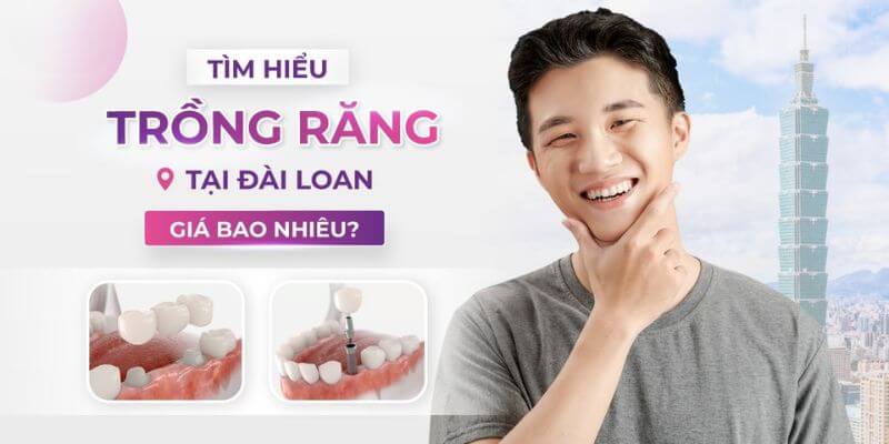 Trồng răng Implant tại Đài Loan giá bao nhiêu?