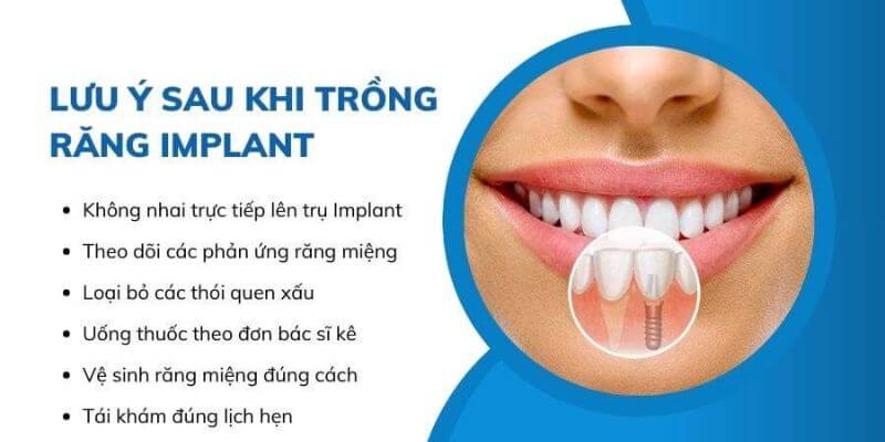 6 lưu ý quan trọng sau khi trồng răng Implant