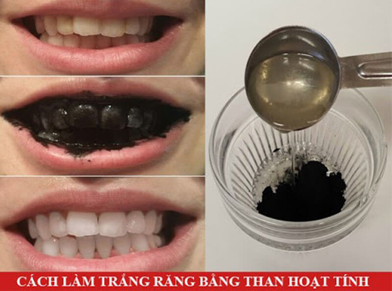 Chỉ nên thực hiện tối đa 2 lần/tuần để tránh làm mòn men răng