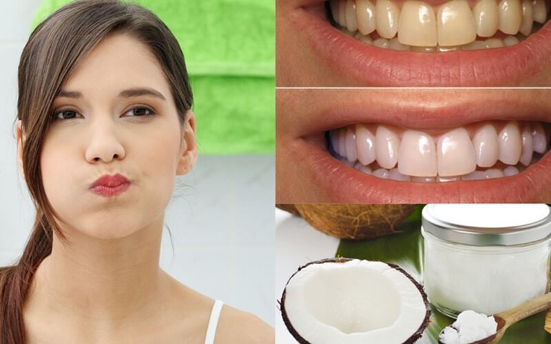 Đánh răng bằng dầu dừa giúp làm sạch răng miệng 