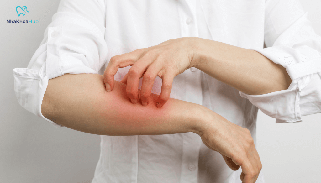 Sau khi sử dụng thuốc, cần theo dõi các phản ứng bất thường như sưng, ngứa, kích ứng và báo ngay cho bác sĩ.