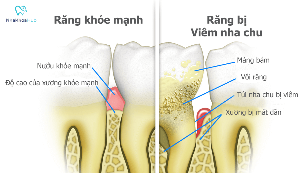 Trước khi đưa ra quyết định xử lý, người bệnh nên tìm hiểu về chi phí điều trị, các phương pháp điều trị phổ biến
