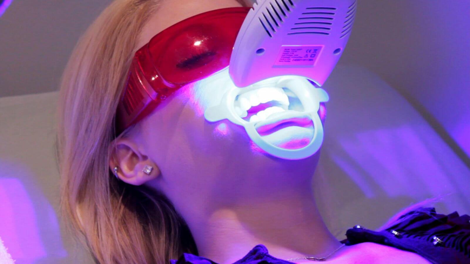 Tẩy trắng răng công nghệ bleachbright được đánh giá cao về độ an toàn và hiệu quả