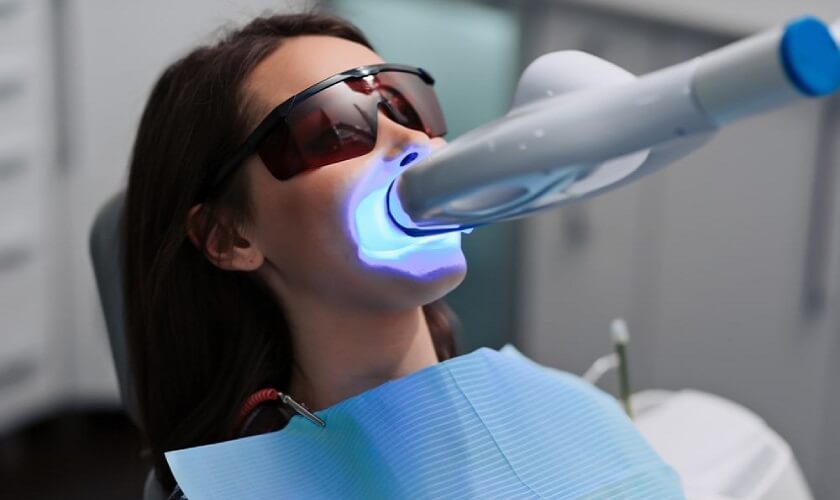 Đèn Plasma phá hủy chuỗi phân từ màu ố vàng, lấy lại vẻ trắng sáng cho răng