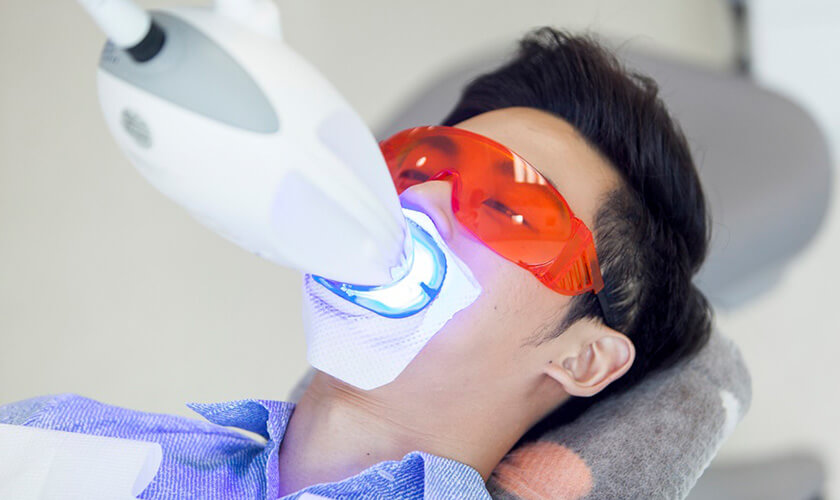 Công nghệ laser whitening sinh nhiệt để kích thích gel làm trắng hoạt động mạnh hơn