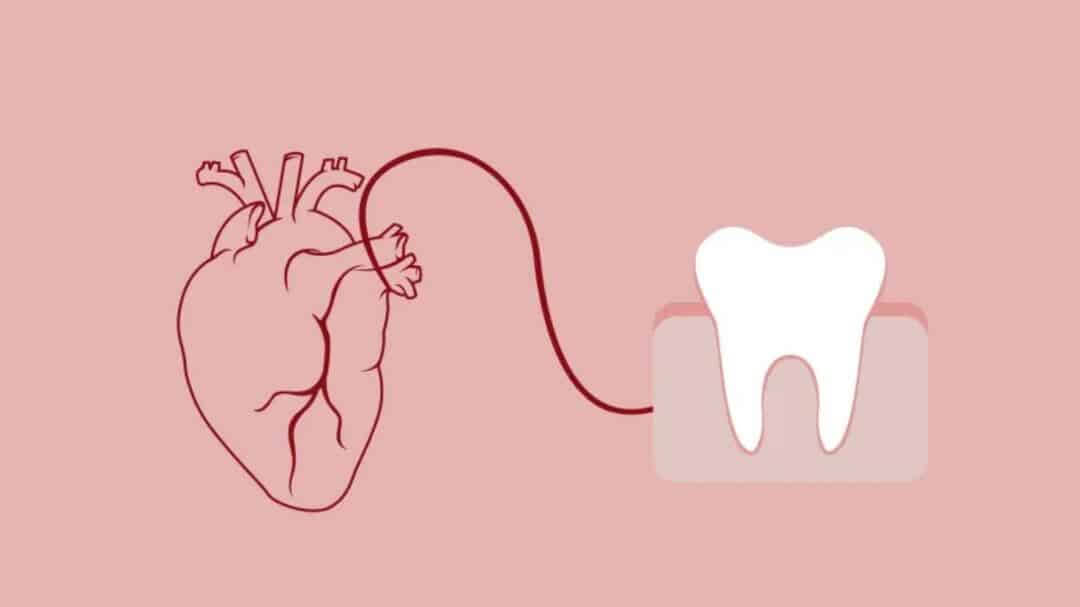 Việc kiểm soát cao răng góp phần bảo vệ sức khỏe hệ hô hấp, tim mạch và tiểu đường