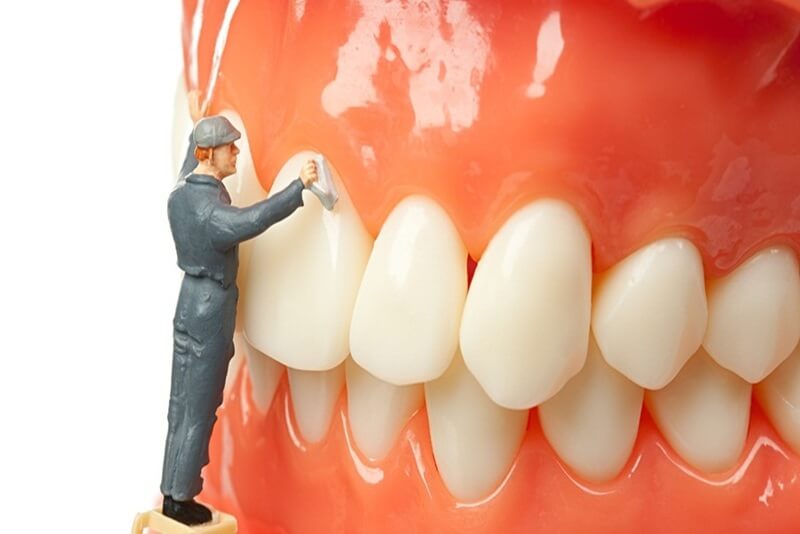 Việc cạo vôi răng liên tục, không theo chỉ định của bác sĩ có thể làm tổn thương men răng và nướu, dẫn đến tình trạng ê buốt hoặc tăng nguy cơ mòn răng